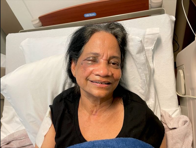 The family of Leelamma Lal, the HCA Florida Palms West Hospital nurse beaten by a patient in February 2025, shared this April 2025 photo of her as she recovers at Brooks Rehabilitation Hospital in Jacksonville. She still is battling double vision in her right eye.