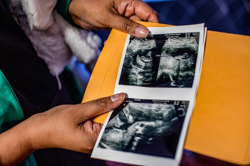 Sveta Prakash Desai, 40, of Troy holds up a recent sonogram she received from her surrogate after a successful in vitro fertilization at her home on Nov. 16, 2023. Desai has breast cancer that is currently in remission. She wanted to have a child after completing cancer treatment, but her body didn't cooperate. After five failed eggs following a retrieval (before her diagnosis) and an aggressive cancer that didn’t allow time for another retrieval, Sveta is now expecting a baby via surrogate this March.
